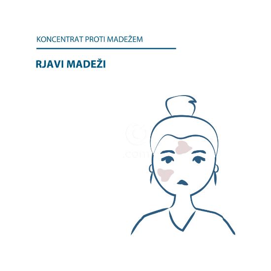 Slika Ducray Melascreen, koncentrat proti madežem (30 ml)