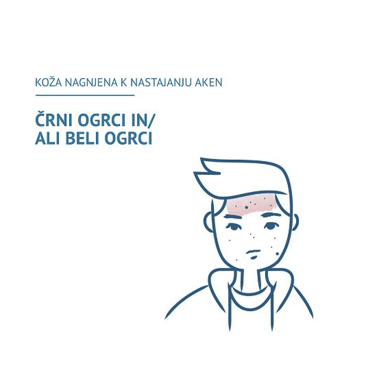 Slika Ducray Keracnyl Glycolic+, krema za odpiranje por (30 ml)