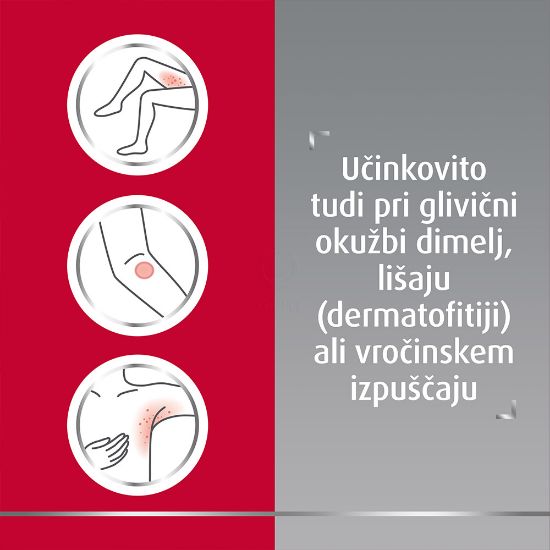 Slika Canespor 10 mg/ml, dermalno pršilo (25 ml raztopina)